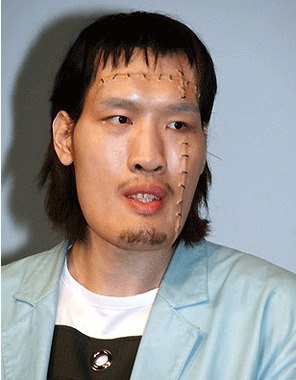 フランケン.png