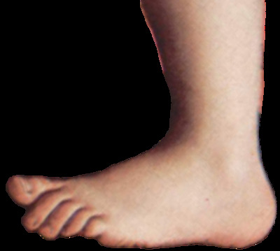 400px-Monty_python_foot.png