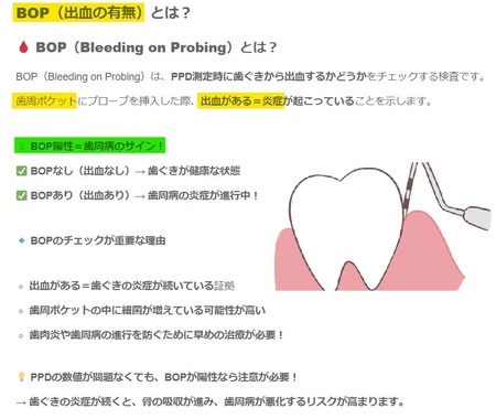 歯周病チェック＝BOP（出血してるか）.jpg